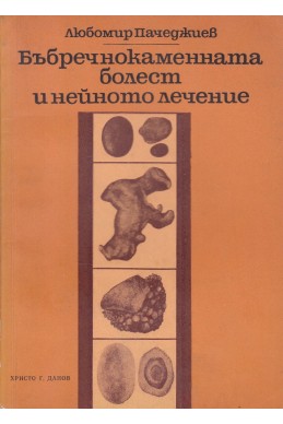 Бъбречнокаменната болест и нейното лечение