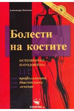 Болести на костите: Остеопороза, пародонтоза